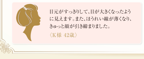 目元がすっきりして、目が大きくなったように見えます。また、ほうれい線が薄くなり、きゅっと顔が引き締まりました。<K様 42歳>