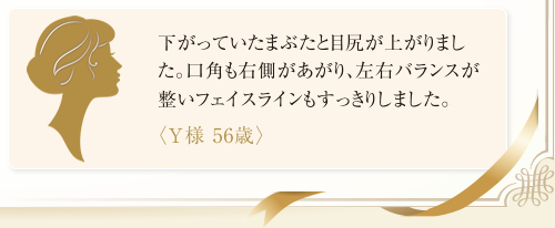 下がっていたまぶたと目尻が上がりました。口角も右側があがり、左右バランスが整いフェイスラインもすっきりしました。<Y様 56歳>