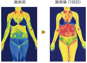 施術前と施術後の体温変化